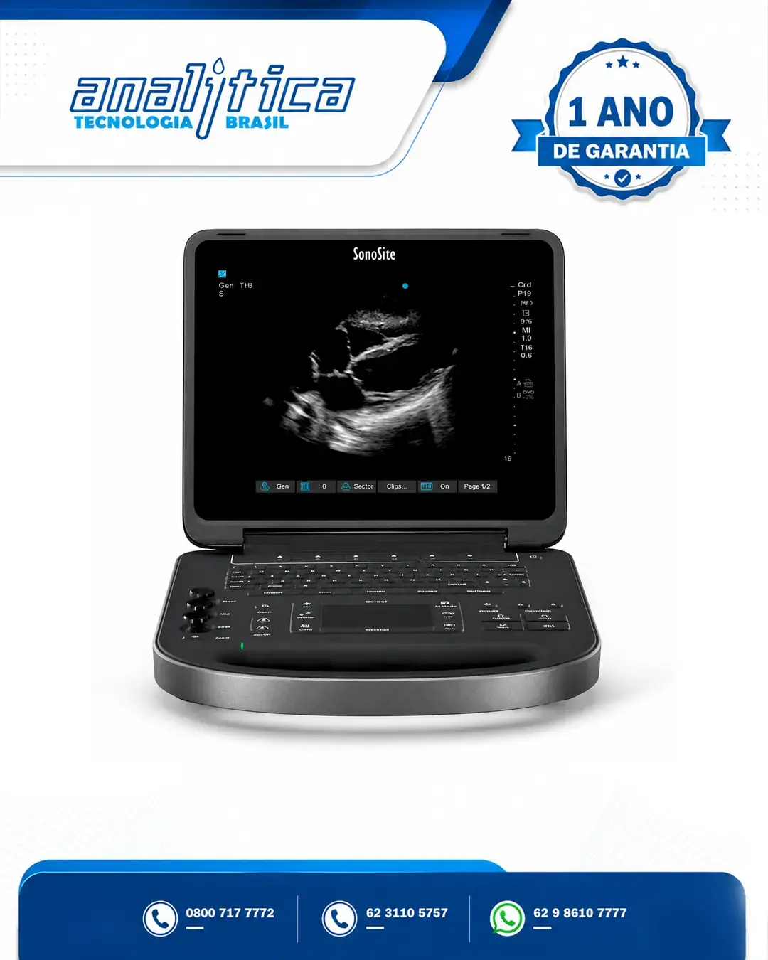 ASSISTÊNCIA TÉCNICA ULTRASSOM SONOSITE EDGE II SÃO PAULO