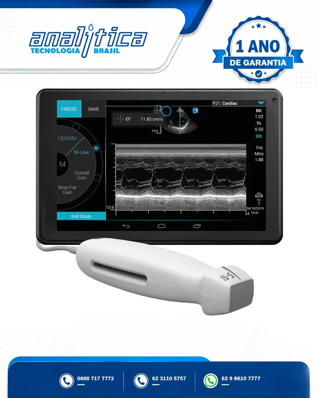 ASSISTÊNCIA TÉCNICA ULTRASSOM SONOSITE IVIZ RIO DE JANEIRO