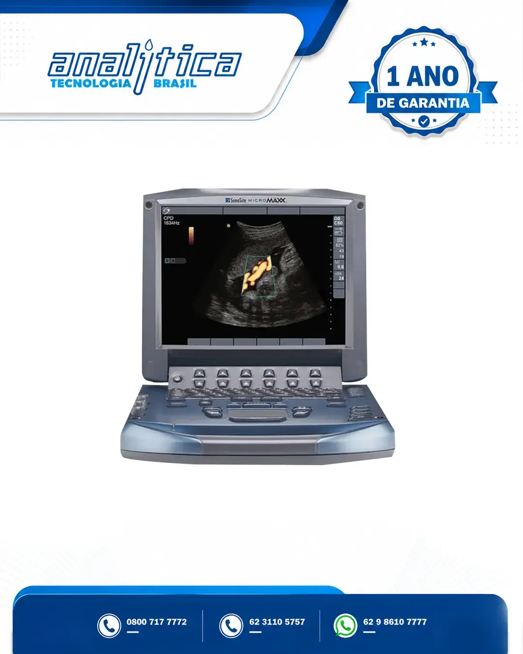 ASSISTÊNCIA TÉCNICA ULTRASSOM SONOSITE MICROMAXX MATO GROSSO