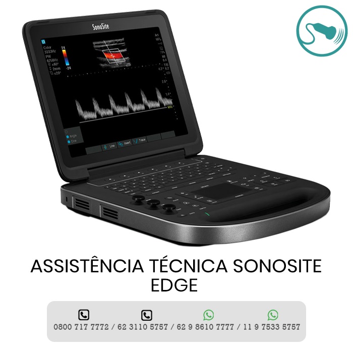 ASSISTÊNCIA TÉCNICA ULTRASSOM SONOSITE EDGE