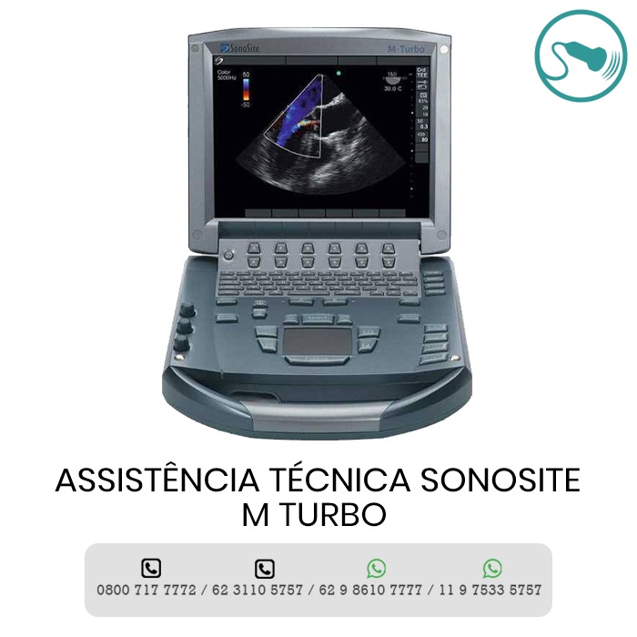 ASSISTÊNCIA TÉCNICA ULTRASSOM SONOSITE M TURBO