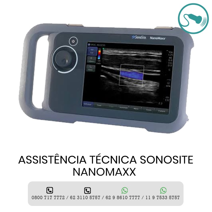 ASSISTÊNCIA TÉCNICA ULTRASSOM SONOSITE NANOMAXX