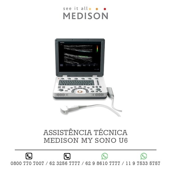 ASSISTENCIA TECNICA ULTRASSOM MEDISON MY SONO U6