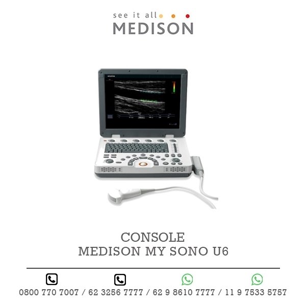 CONSOLE ULTRASSOM MEDISON MY SONO U6
