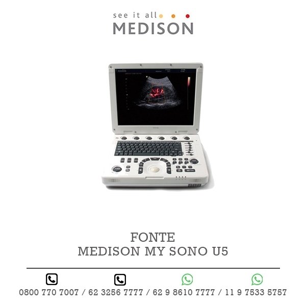 FONTE ULTRASSOM MEDISON MY SONO U5